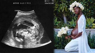 Fact-Checking Lil Nas X's Pregnancy Stunt: Viral Prank or Boundary-Pushing Art?