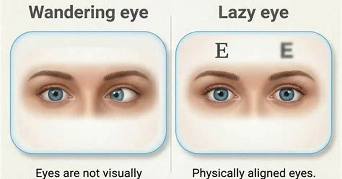 Why the 'Wandering Eye' Discourse Is Exploding Across Social Media Right Now